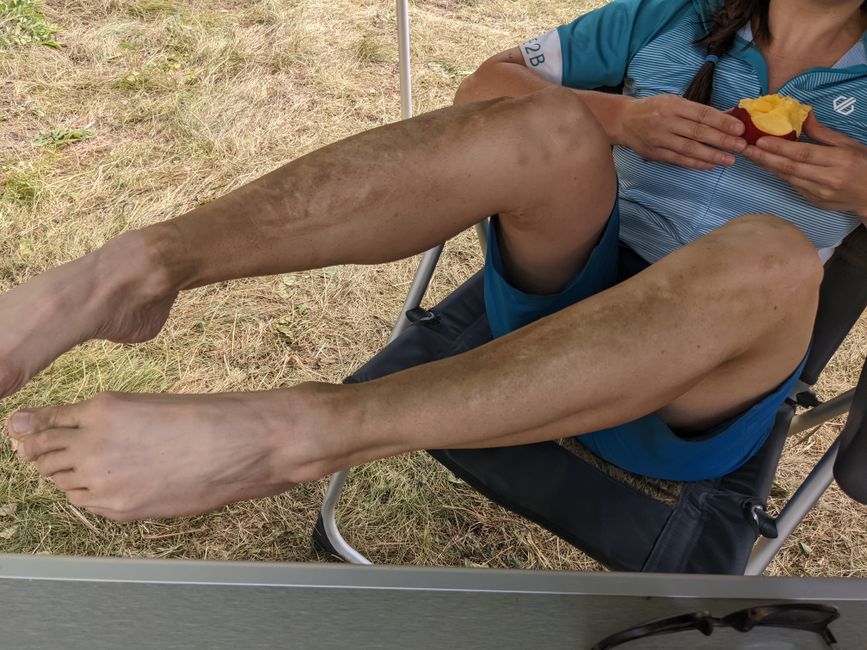 Dirt on the leg