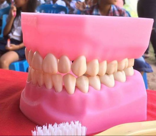 Tooth model