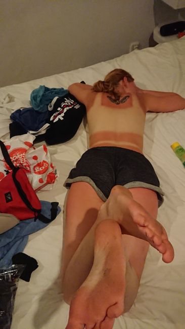 Slight sunburn after snorkeling