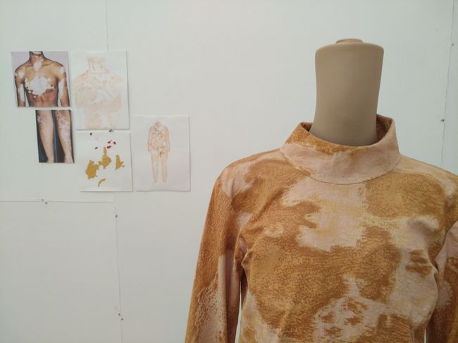 Sheshadep Sagriya, 'Unwanted Skin' (Students' Biennale)
